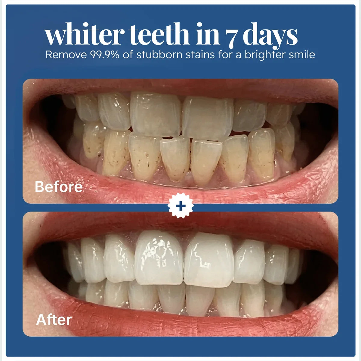 EcoBrightSmiles® Triple Action Teeth Whitening Powder